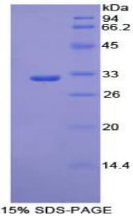 Mouse PCK1 Protein (Recombinant His-T7)