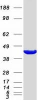 Human ACAA1 Protein (Recombinant Myc-DDK (Flag))
