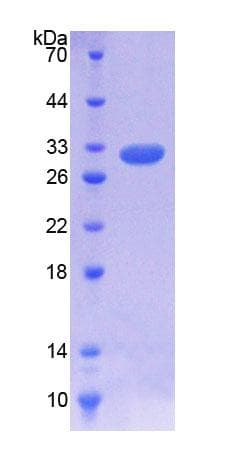 Rat IL7R / CD127 Protein (Recombinant His-T7)