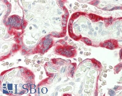 PathPlus™ CGB / hCG Beta Antibody (Beta 2, clone INN-hCG-22)