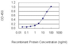 TRPC1 Antibody (clone 1E4)
