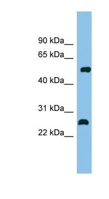 MEF2D Antibody (C-Terminus)