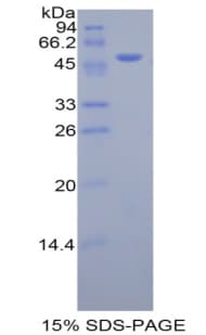 Human KLK7 / Kallikrein 7 Protein (Recombinant His-GST)