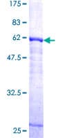 Human CTSK / Cathepsin K Protein (Recombinant GST)