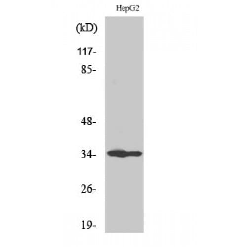UNG / Uracil DNA Glycosylase Antibody (160-240 aa, Internal)