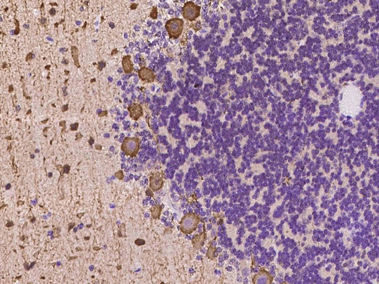 ST6GAL2 Antibody