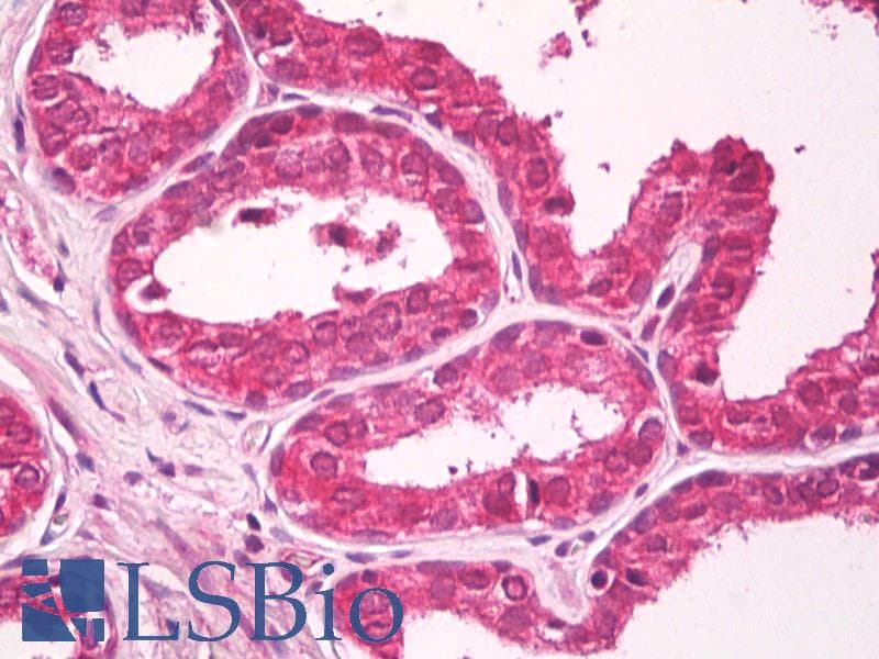 IHC-plus™ CXADR Antibody