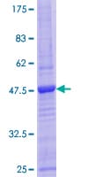 Human CD3D Protein (Recombinant GST)