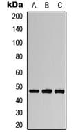 Polyclonal Rabbit anti-Human AURKA / Aurora-A Antibody (phospho-Thr288, IHC, IF, WB)