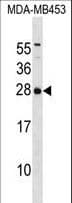 Polyclonal Rabbit anti-Human ITPA Antibody (aa149-178, WB)