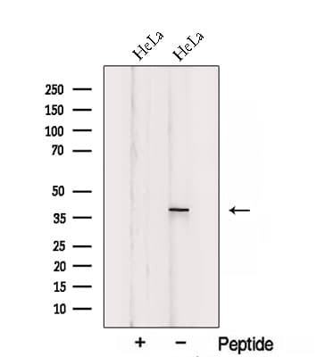 SIRT6 / Sirtuin 6 Antibody