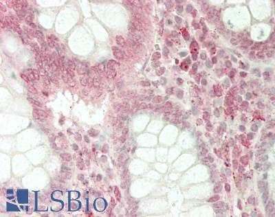 IHC-plus™ LY96 / MD2 / MD-2 Antibody (clone 1A2E3)