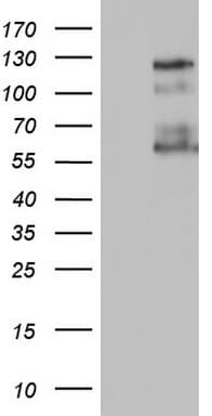 GLI / GLI1 Antibody (aa755-1106, clone OTI2D8)