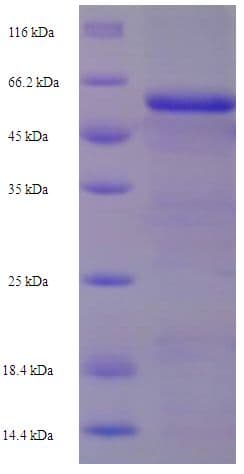 Human SERPINE2 / Nexin Protein (Recombinant His-SUMO)