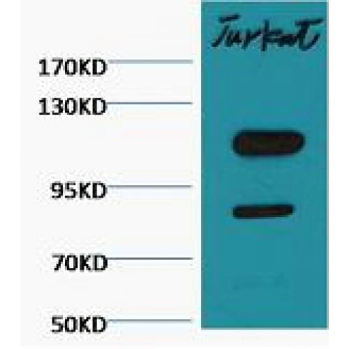 PARP1 Antibody (clone Mix)