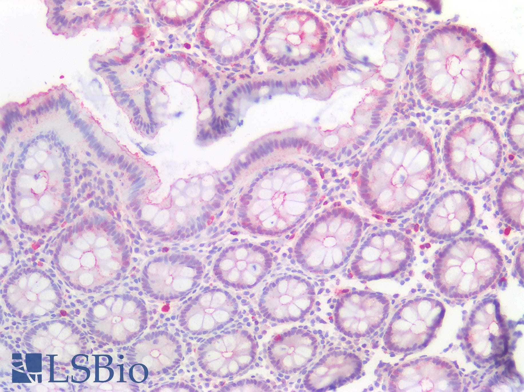 IHC-plus™ VIL1 / Villin Antibody (aa7-246)