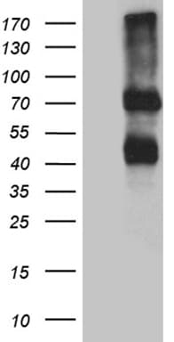 IL2RB / CD122 Antibody (aa27-240+Mouse, clone OTI5A5)