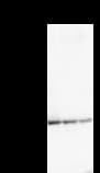 NARG1 / NAA15 Antibody (clone 434C2a)