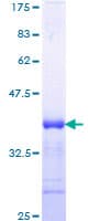 Human TGFBR1 / ALK5 Protein (Recombinant GST, N-terminus)
