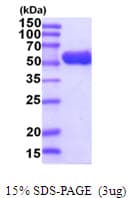 E. coli GK / Glycerol Kinase Protein (Recombinant His)