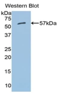 ALDH7A1 Antibody (aa28-539, APC)