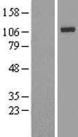 IREB2 / IRP2 Protein (Over-Expression Lysate Myc-DDK (Flag))