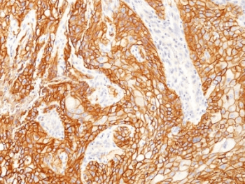 EGFR Antibody (clone GFR/2341)