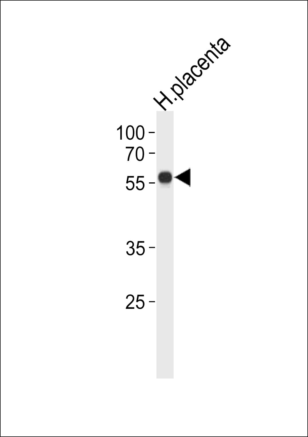 ZNF71 Antibody (aa74-101)