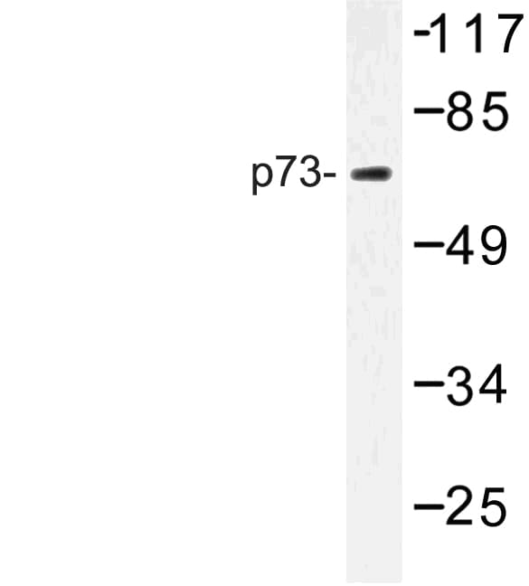 TP73 / p73 Antibody (Pro298)
