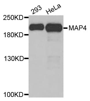 Polyclonal Rabbit anti-Human MAP4 Antibody (AP, IHC, WB)