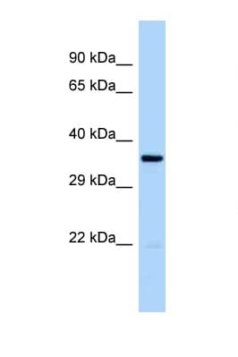 Polyclonal Rabbit anti-Human CDK20 / CCRK Antibody (aa159-208, WB)