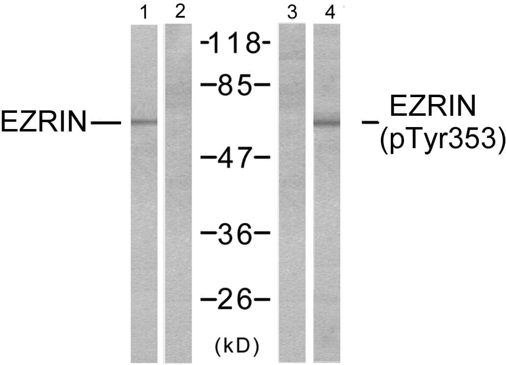 EZR / Ezrin Antibody (p353)