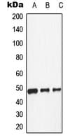 Polyclonal Rabbit anti-Human DRD1 / Dopamine Receptor D1 Antibody (Internal, WB)