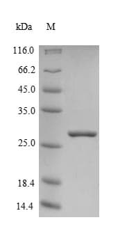 Human FXN / Frataxin Protein (Recombinant 10His, N-terminus + Myc, C-terminus)