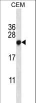 CBX5 / HP1 Alpha Antibody (aa88-117)