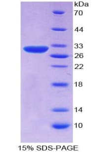 Human SERPINB3 Protein (Recombinant His-T7)