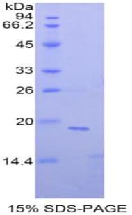 Mouse NME4 Protein (Recombinant His-T7)