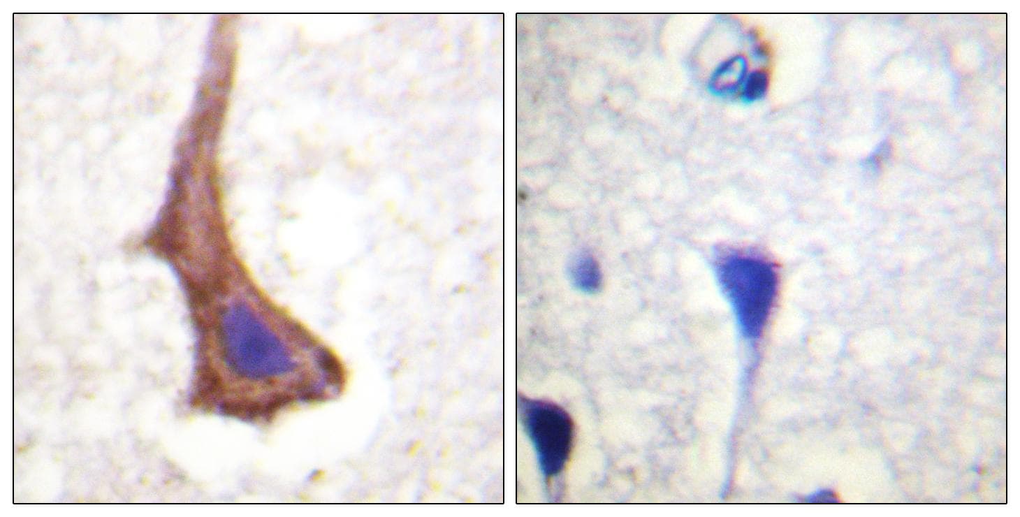 CSF1R / CD115 / FMS Antibody (Ab-561)