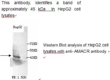 Polyclonal Rabbit anti-Human AMACR / P504S Antibody (WB)