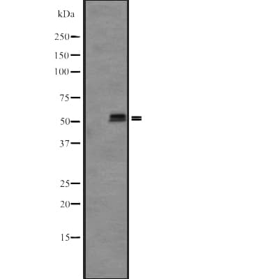 KRT85 / Keratin 85 / KRTHB5 Antibody