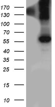 Monoclonal Mouse anti-Human BMP6 Antibody (clone OTI4A3, aa21-374, WB)
