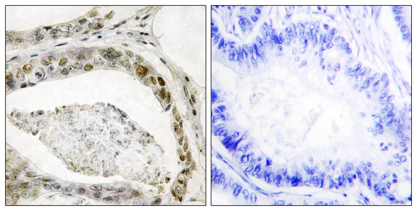 SMAD3 Antibody (phospho-Ser208)