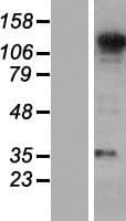 SEC31A / HSPC275 Protein (Over-Expression Lysate Myc-DDK (Flag))