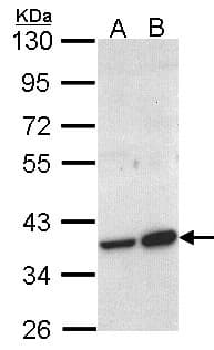 Polyclonal Rabbit anti-Human ACMSD Antibody (aa105-336, IHC, WB)