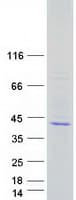 Human SCAMP2 Protein (Recombinant Myc-DDK (Flag))