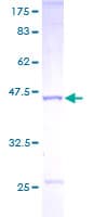 Human NME1 / NM23 Protein (Recombinant GST)