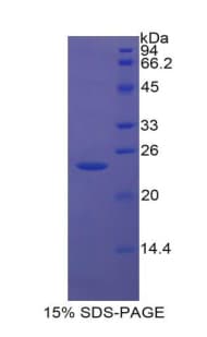 Rat IGFBP6 Protein (Recombinant His-T7)
