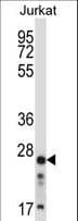 Polyclonal Rabbit anti-Human ARHGDIB / D4 GDI Antibody (aa160-188, IHC, WB)