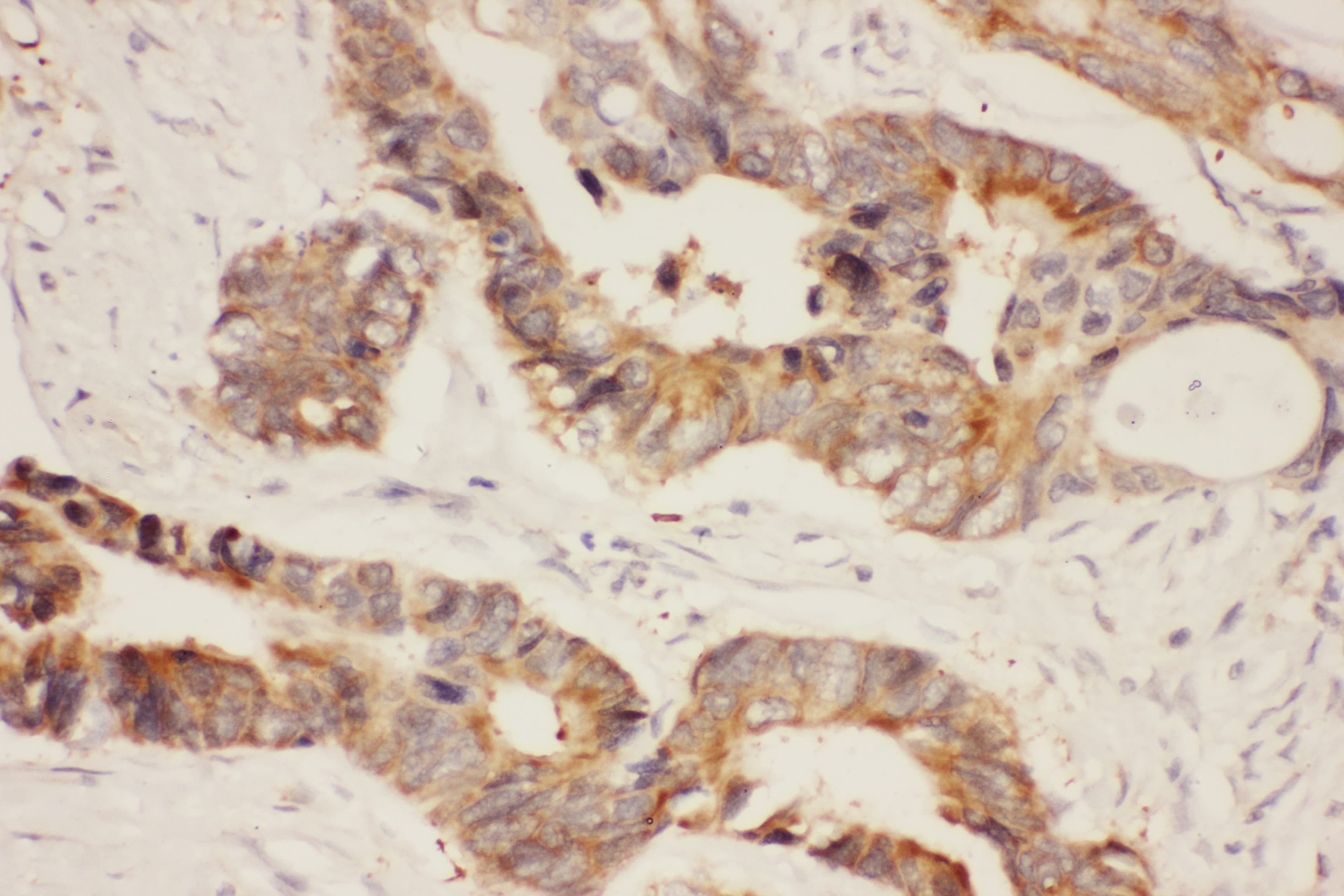 HSP90AA1 / Hsp90 Alpha A1 Antibody (aa2-365)