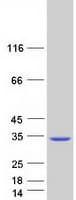 Human DGCR6L Protein (Recombinant Myc-DDK (Flag))